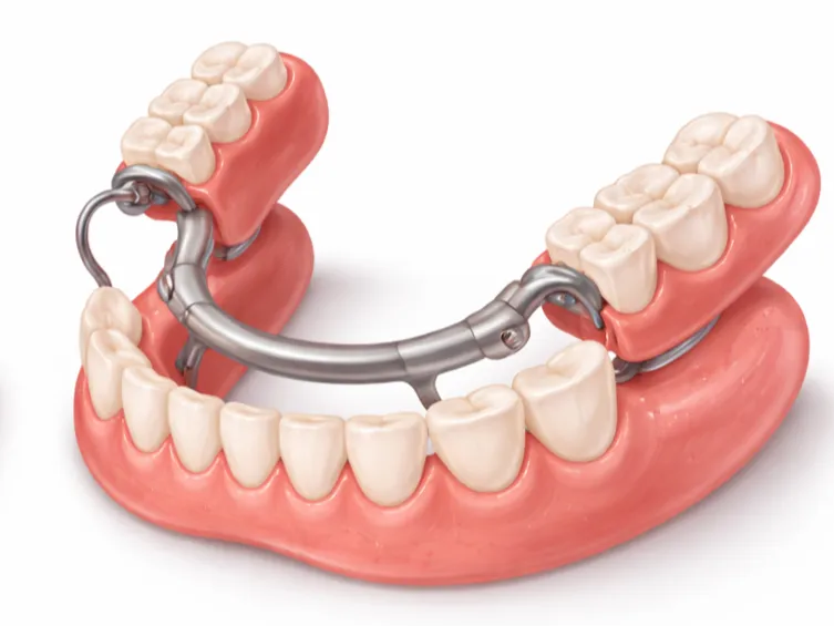 Custom dentures