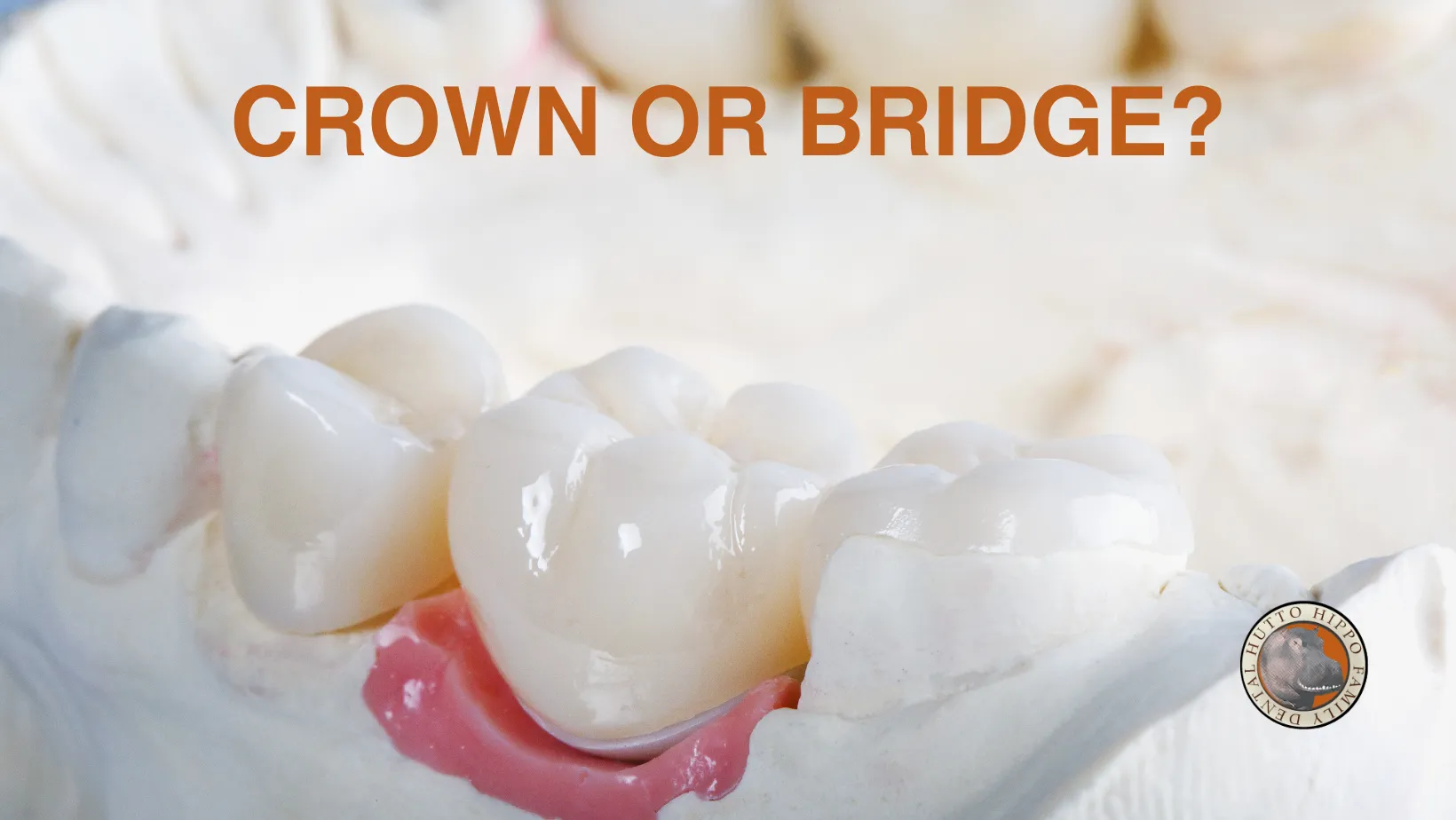 Cover for What Dental Conditions Can Be Treated with a Crown or Bridge?