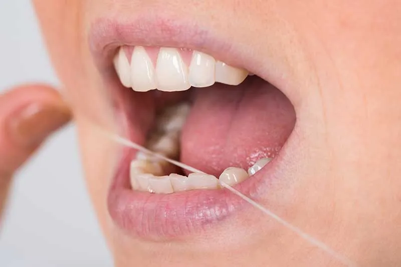 Cover for Five Simple Steps for Flossing Teeth