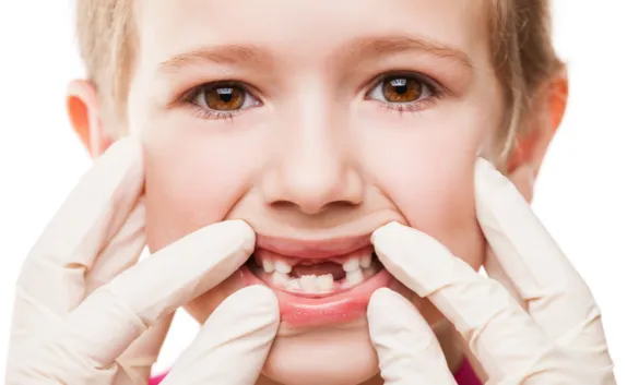 Cover for Tips to Help Protect Your Young Child’s Teeth