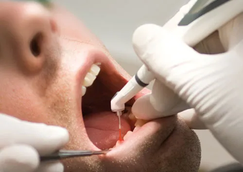 Cover for Why Is Dental Cleaning and Good Dental Hygiene Important?