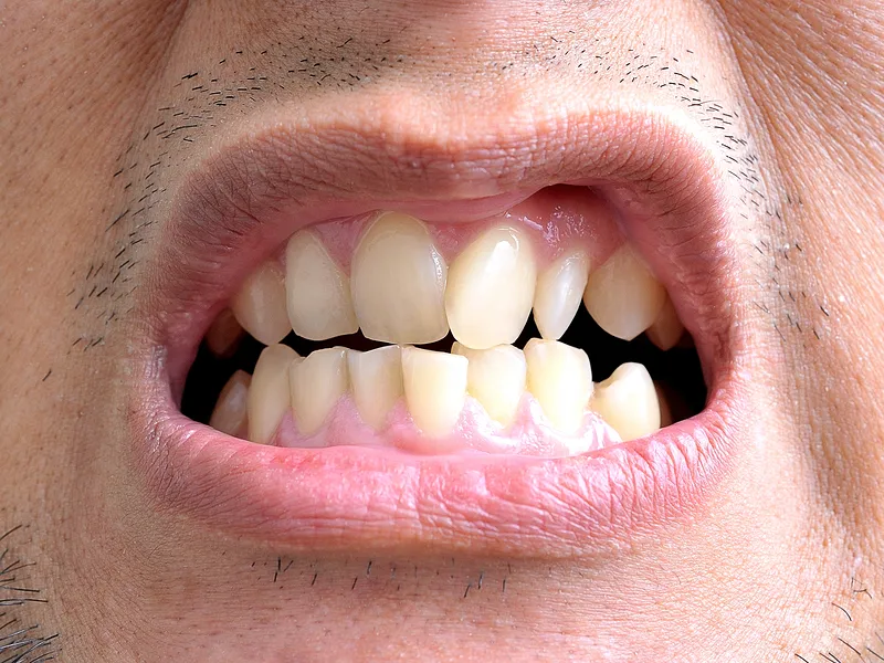 Cover for Reasons for Orthodontic Treatment, Braces