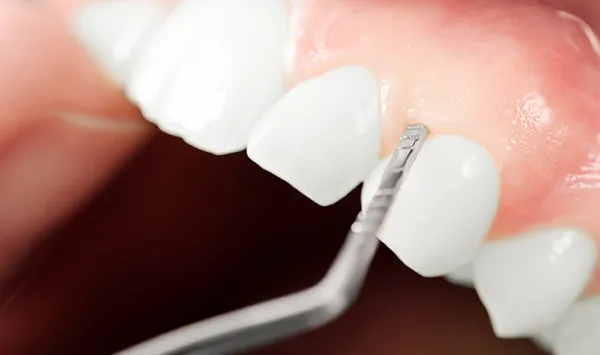Cover for Gums: What Can the Color or Condition Reveal?