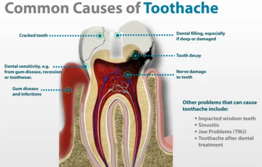 Cover for What Can Cause a Toothache and Why Does It Hurt?