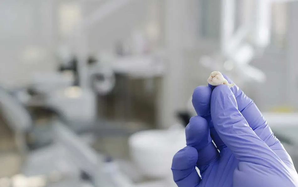 Cover for Wisdom Tooth Removal: Remove or Leave a Non-Painful Wisdom Tooth?