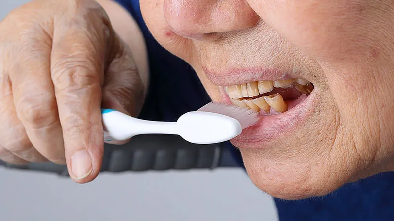 Cover for Tooth Erosion: How You Eat and Drink Can Make a Difference