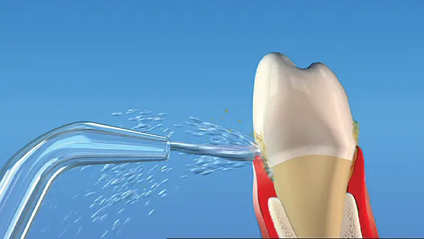 Cover for Waterpik® Water Flosser for Healthy Gums