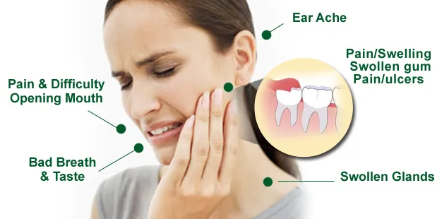 Cover for What Should You Do About Your Wisdom Teeth?