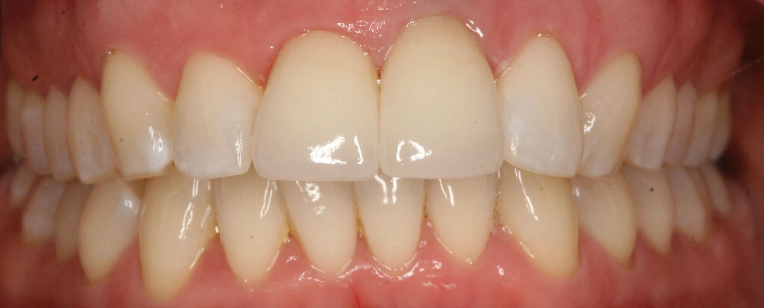Cover for Top Dental Research Discoveries in 2017