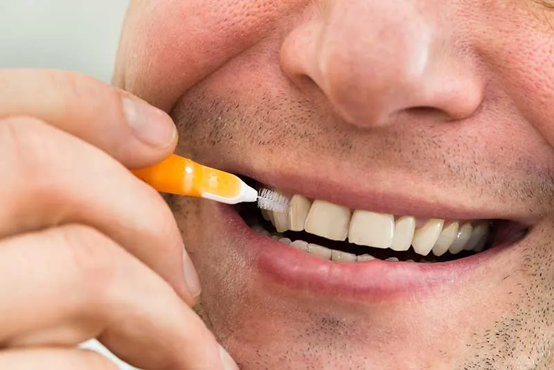 Cover for FAQs About an Interdental Cleaning Brush