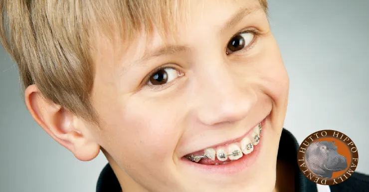 Cover for Dental Hygiene Guidelines that Are Vital for Kids Wearing Braces