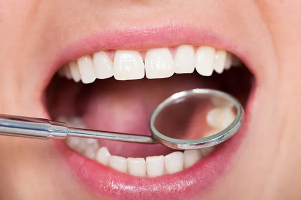 Cover for Gum Graft Surgery: Preparation and Recovery