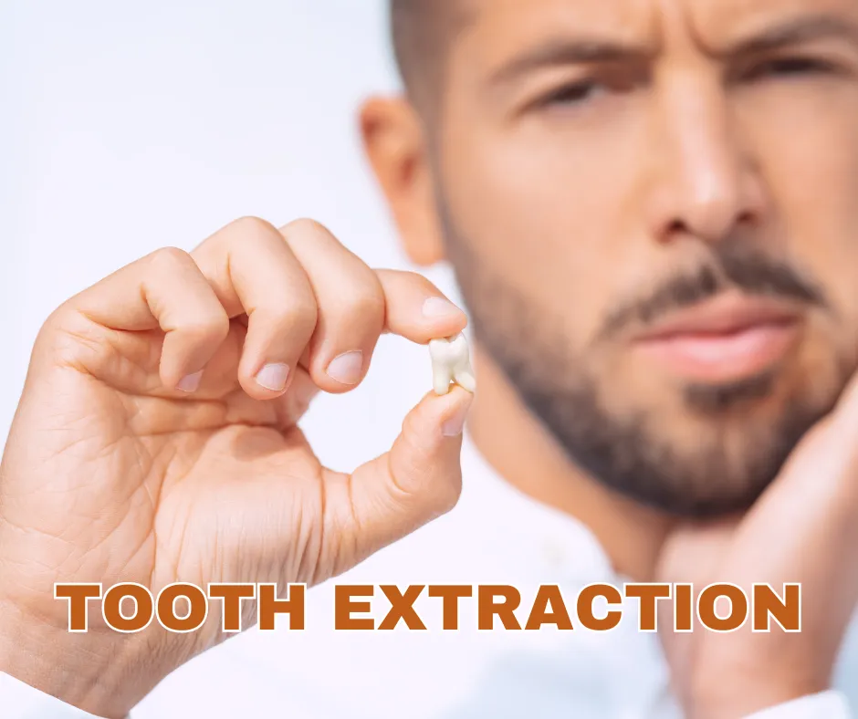 Cover for The Things You Need to Know about Tooth Extraction