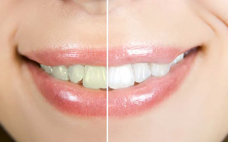 Cover for Overall Health and Dental Health Benefits of Dark Chocolate