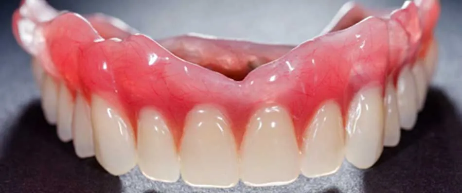 Cover for Dentures: What You Should Know About Them